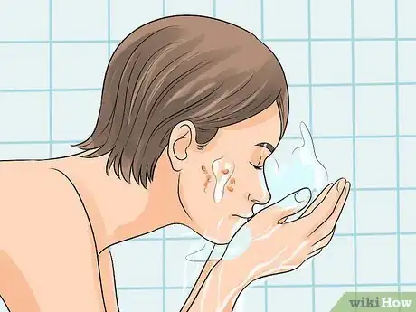 Image intitulée Deal With Pimples Step 9