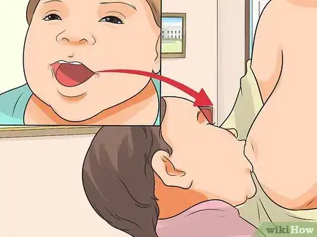 Image intitulée Heal a Cracked Nipple when Breastfeeding Step 7