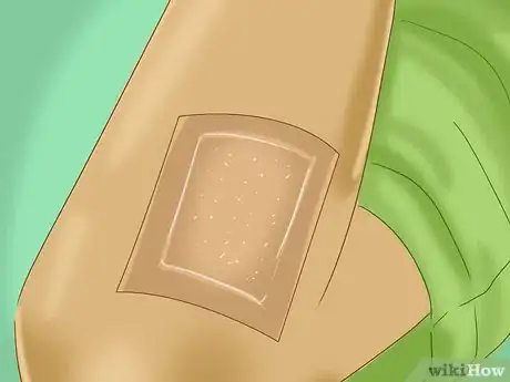 Image intitulée Treat a Skin Flap or Abrasion During First Aid Step 7