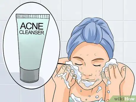 Image intitulée Decrease the Size of a Pimple Overnight Step 11