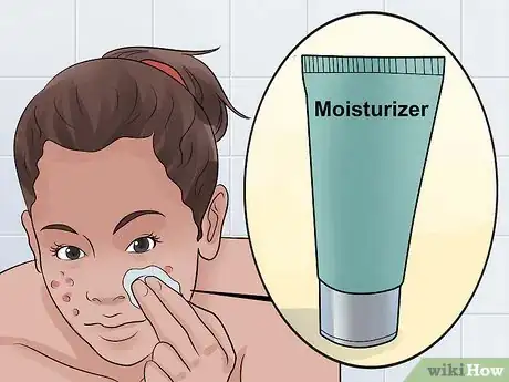 Image intitulée Decrease the Size of a Pimple Overnight Step 16