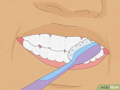 Image intitulée Fix Crooked Teeth Step 27