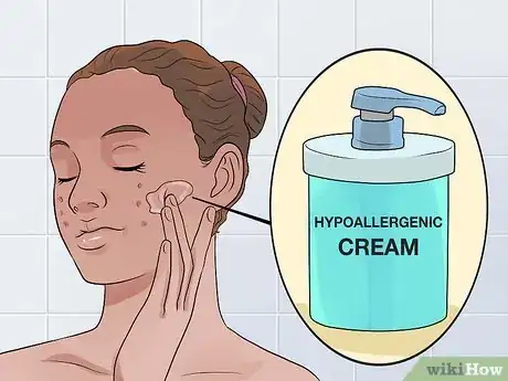 Image intitulée Decrease the Size of a Pimple Overnight Step 18