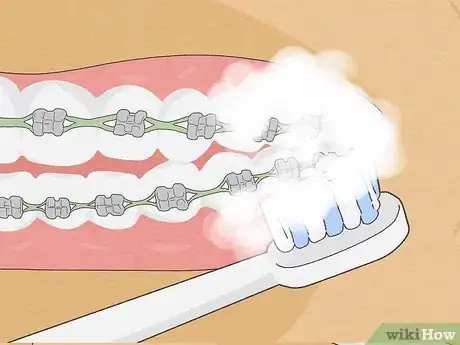 Image intitulée Fix Crooked Teeth Step 22