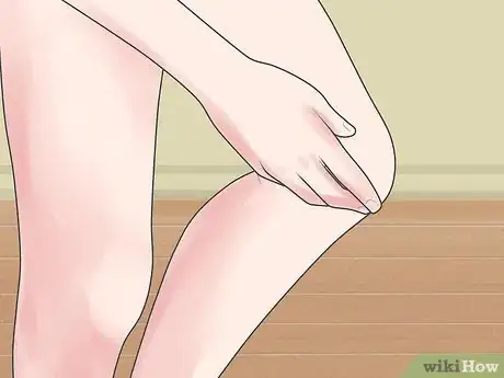 Image intitulée Tell if You Strained Your Knee Step 2