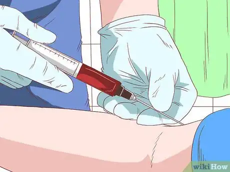 Image intitulée Recognize Fetal Alcohol Syndrome Step 8