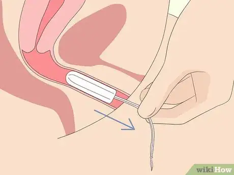Image intitulée Use a Tampon Step 7