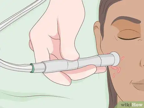 Image intitulée Get Rid of Keloids Step 4
