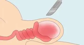 traiter des douleurs et une inflammation des testicules
