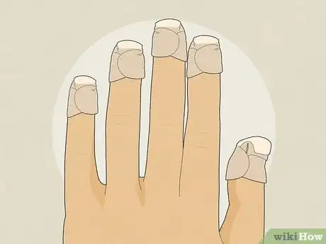 Image intitulée Stop Biting Your Nails Step 23