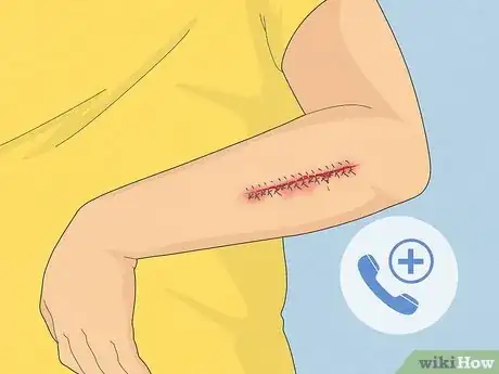 Image intitulée Take a Shower After Surgery Step 18