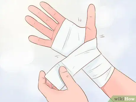 Image intitulée Fake an Injury Step 13