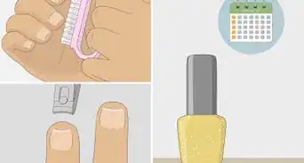 se débarrasser d'une mycose de l'ongle