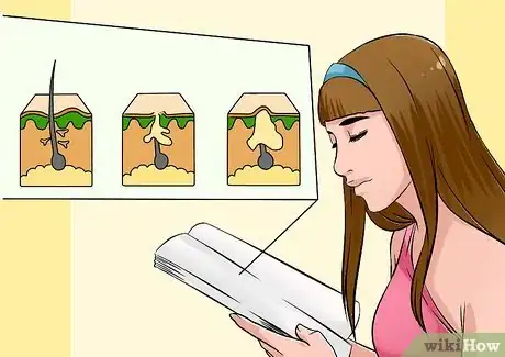 Image intitulée Get Rid of Acne Naturally Step 21