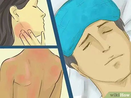 Image intitulée Treat a Sunburn Step 3