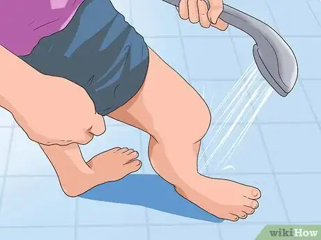 Image intitulée Reduce Edema Naturally Step 20