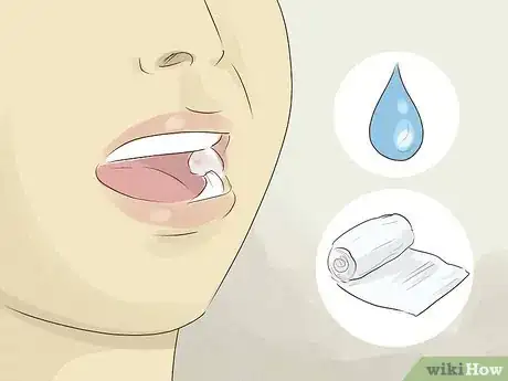 Image intitulée Recover after Wisdom Teeth Surgery Step 3
