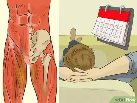 Image intitulée Treat a Groin Injury Step 12