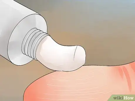 Image intitulée Tell if a Tattoo Is Infected Step 7