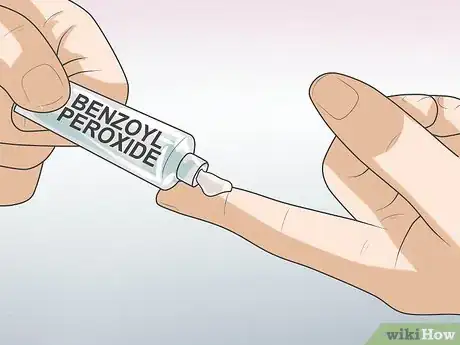 Image intitulée Get Rid of Acne on Your Nose Step 1