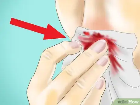 Image intitulée Keep the Nose Moist to Prevent Nosebleeds Step 10