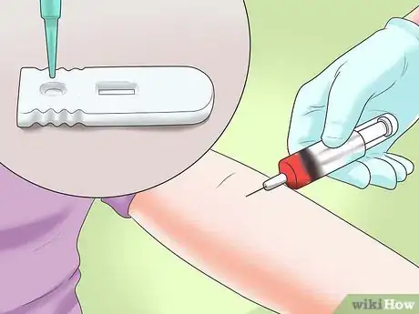 Image intitulée Lower CRP (C‐Reactive Protein) Step 15