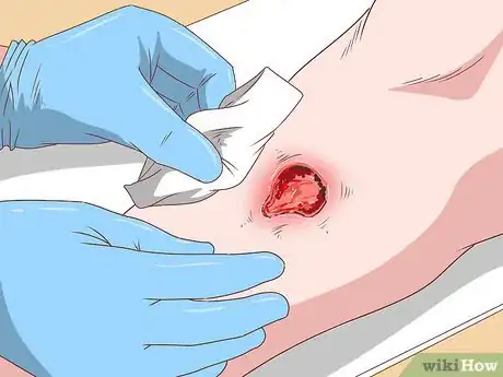 Image intitulée Know if You Have Jungle Rot Step 13