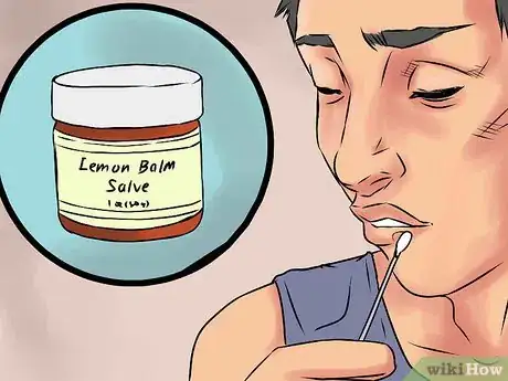 Image intitulée Prevent a Cold Sore from Forming Step 10