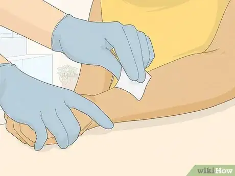 Image intitulée Read Allergy Skin Test Results Step 2