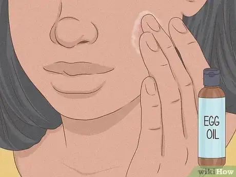 Image intitulée Get Rid of a Zit Overnight Step 7