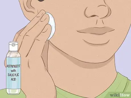 Image intitulée Get Rid of a Zit Overnight Step 6