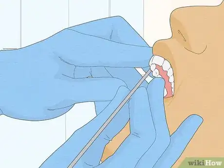 Image intitulée Fix Crooked Teeth Step 21