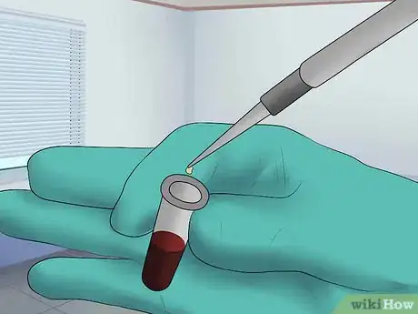 Image intitulée Know if You Have an Enlarged Liver Step 11