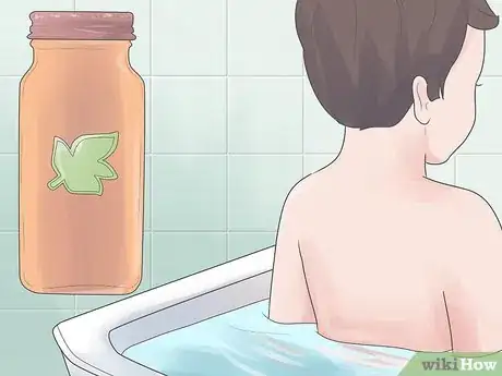 Image intitulée Treat Chickenpox at Home Step 16