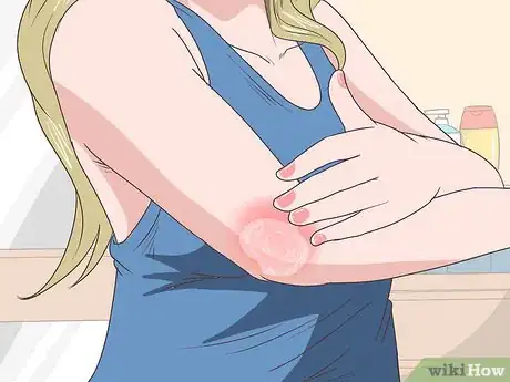Image intitulée Apply Vicks VapoRub Step 7