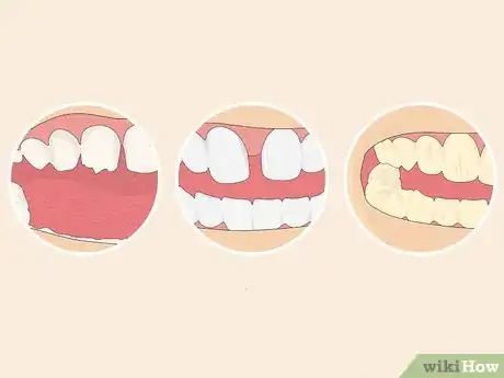Image intitulée Fix Crooked Teeth Step 13