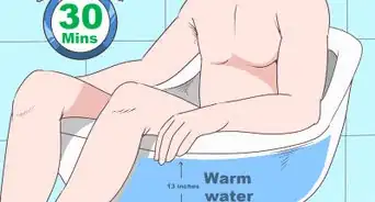 savoir si vous avez une épididymite