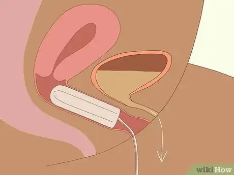 Image intitulée Use a Tampon Step 6