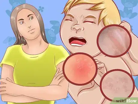 Image intitulée Apply Diaper Cream Step 1
