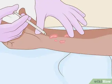 Image intitulée Get Rid of Keloids Step 3