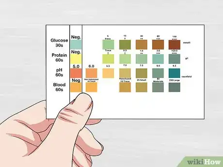 Image intitulée Use a Urine Dipstick Test Step 9