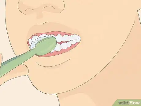 Image intitulée Fix Crooked Teeth Step 15
