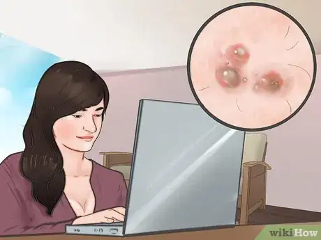 Image intitulée Know If You Have Herpes Step 8