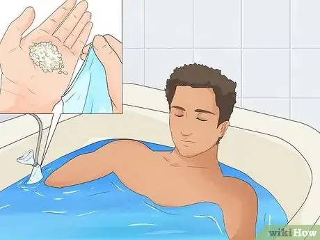 Image intitulée Treat Eczema Naturally Step 10