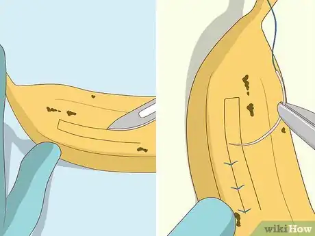 Image intitulée Practice Surgery Skills on Fruit Step 8