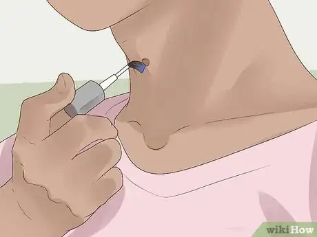 Image intitulée Get Rid of Skin Tags Step 18
