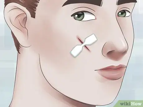 Image intitulée Get Rid of a Cut on Your Face Step 7