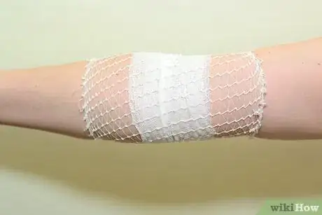 Image intitulée Strap an Elbow Step 12