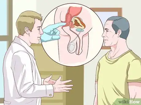 Image intitulée Self Screen for Colon Cancer Step 1