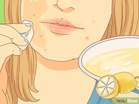 Image intitulée Get Rid of Dark Spots Step 1